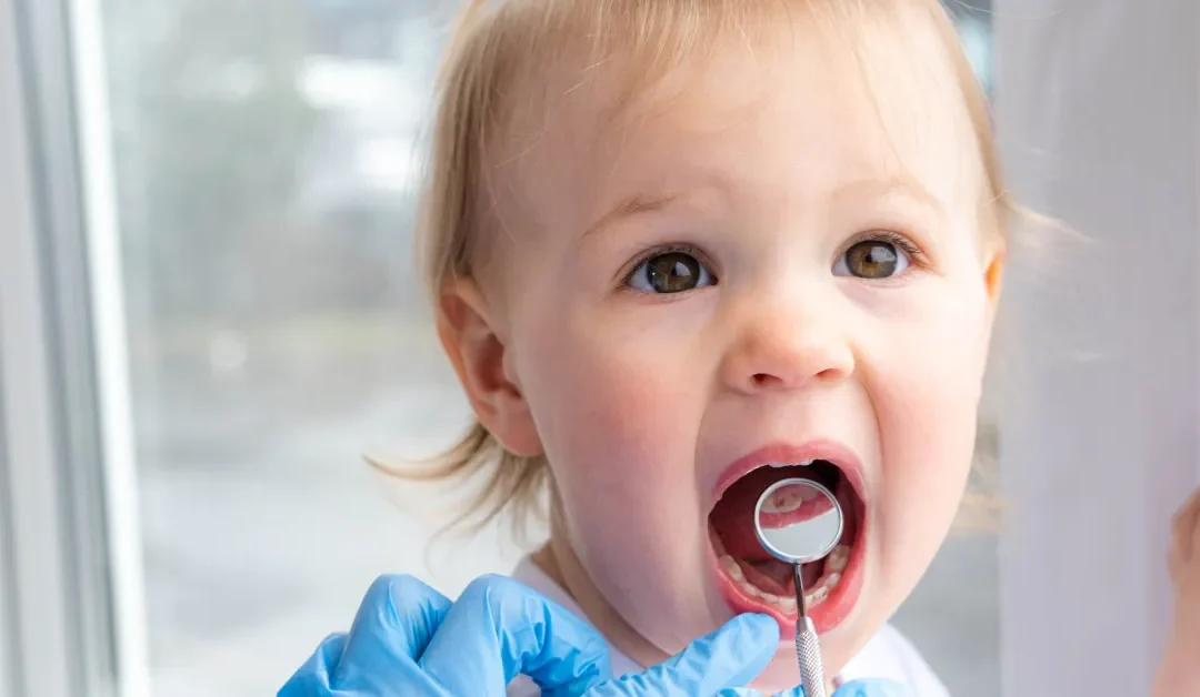 What Parents Need to Know About Lip & Tongue Ties