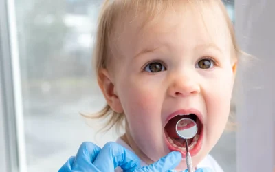What Parents Need to Know About Lip & Tongue Ties